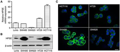 Heparanase Promotes Tumor Growth and Liver Metastasis of Colorectal Cancer Cells by Activating the p38/MMP1 Axis